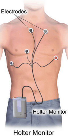 holter