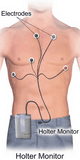 Holter